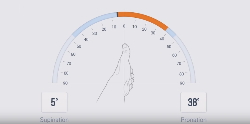 smart glove rehabilitation game